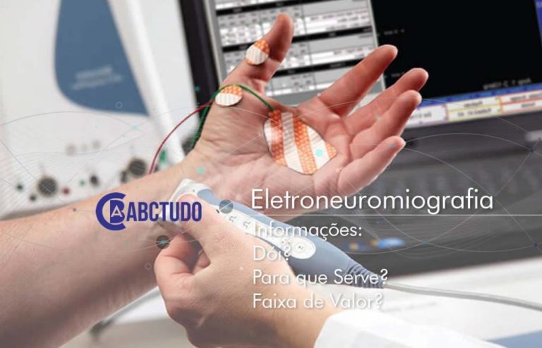 Eletroneuromiografia (EMG): O que é este Exame? | Portal de noticias ABCTudo